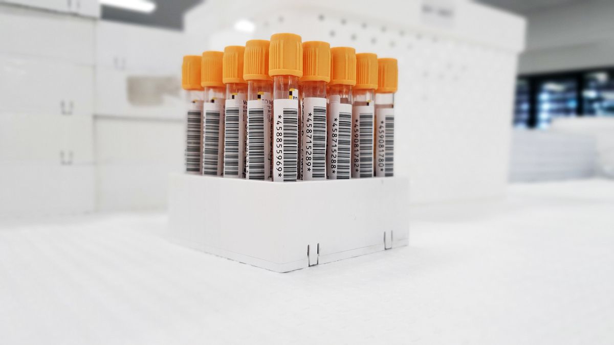 Row of labeled blood sample tubes in a laboratory rack