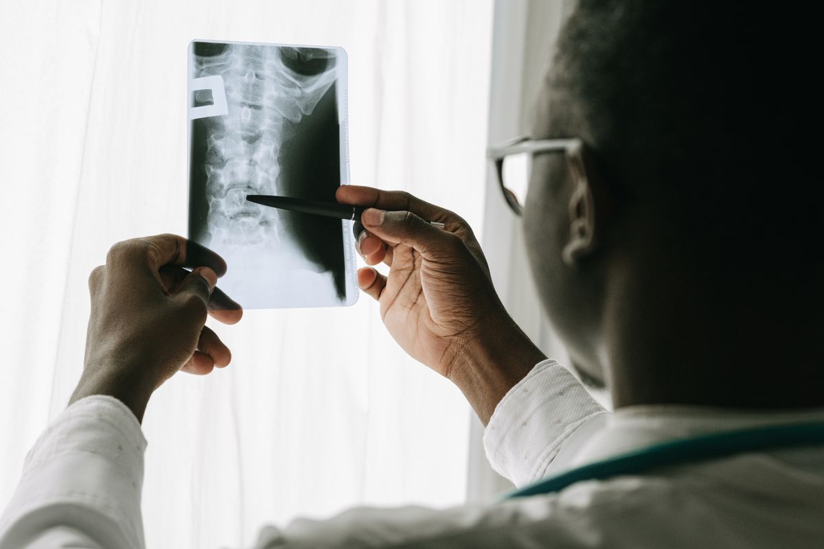 Doctor examining a spinal X-ray film by a window